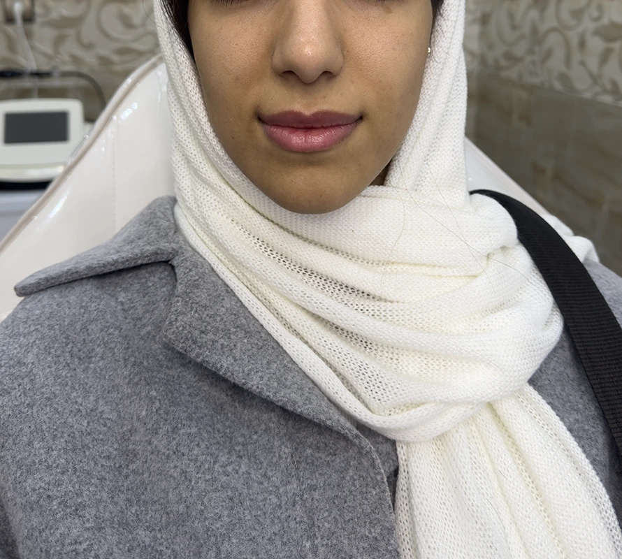 قبل از تزریق ژل لب