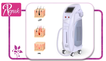 لیزر موهای زائد در خمینی شهر