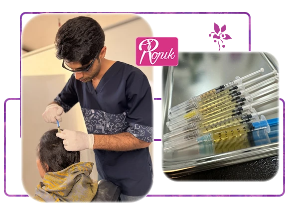 درمان پی آر پی