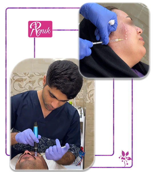 کاربردهای شگفتانگیز مزوتراپی رونیک