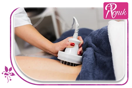 لاغری موضعی آر اف